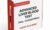Advanced Liver Blood Test: Essential Guide for Maidstone Residents
