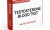 Testosterone Blood Test Essentials for Sheffield Residents