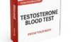 Testosterone Blood Test: Key Details for Residents of Darlington
